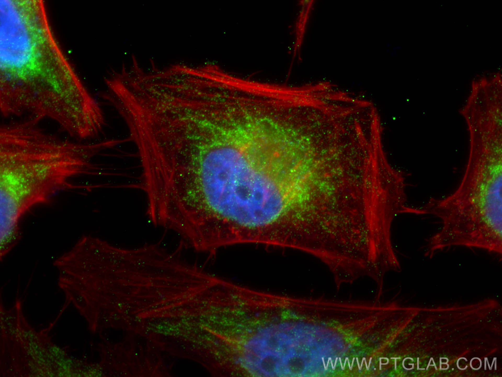 IF Staining of HeLa using 83440-2-RR (same clone as 83440-2-PBS)