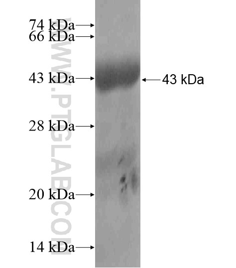 TMEM127 fusion protein Ag19447 SDS-PAGE TMEM127 fusion protein Ag19447 SDS-PAGE