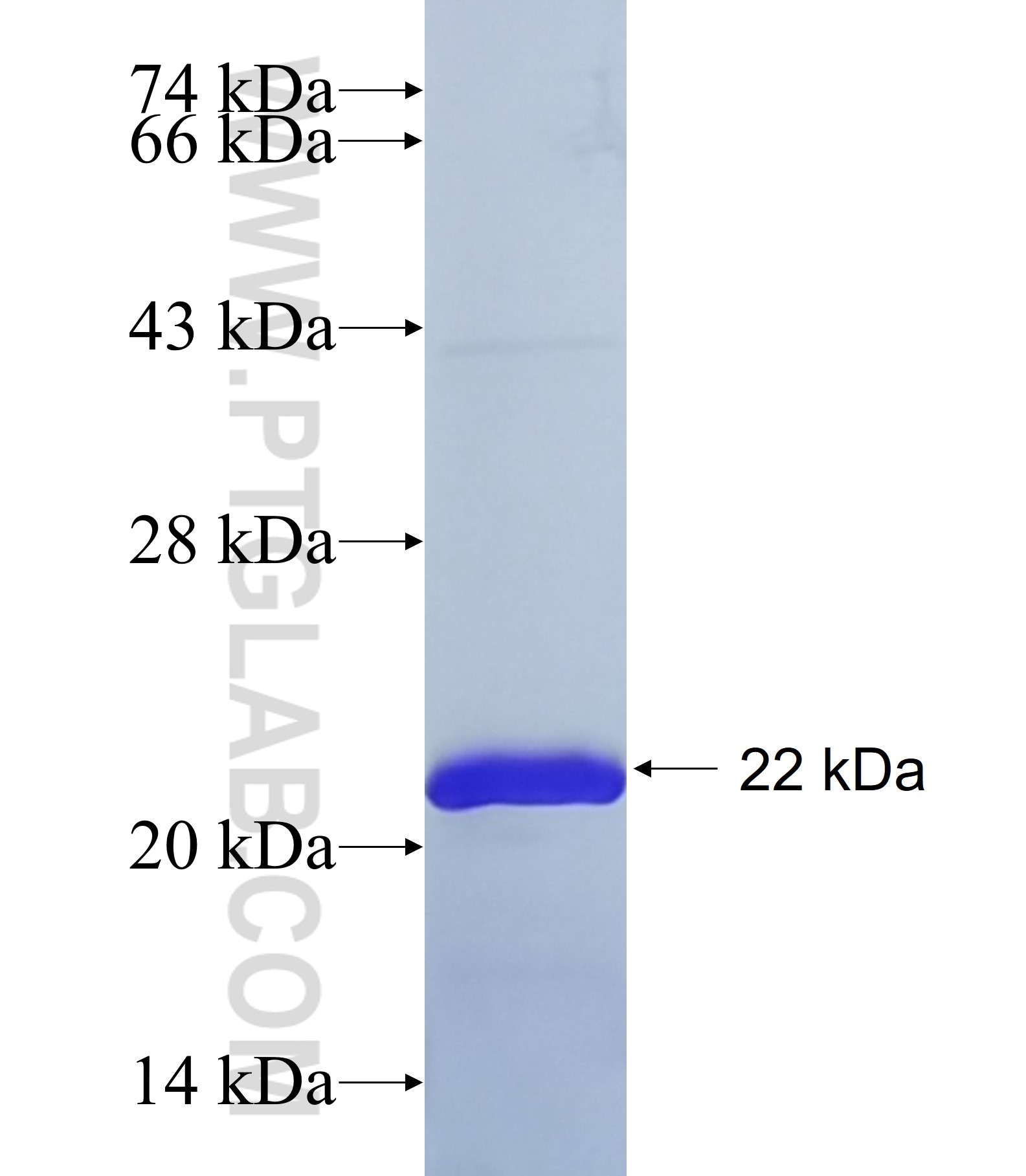 TMEM132C fusion protein Ag36121 SDS-PAGE TMEM132C fusion protein Ag36121 SDS-PAGE
