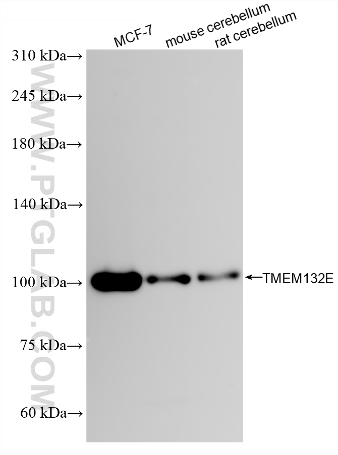 WB analysis using 82983-2-RR (same clone as 82983-2-PBS)