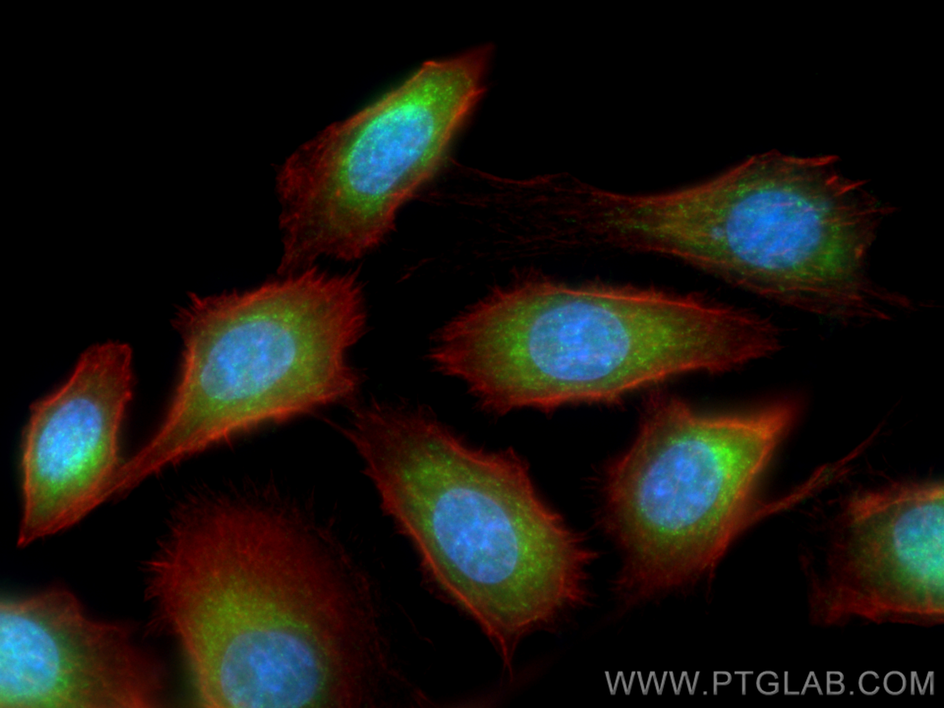 IF Staining of PC-3 using 25078-1-AP (same clone as 25078-1-PBS)