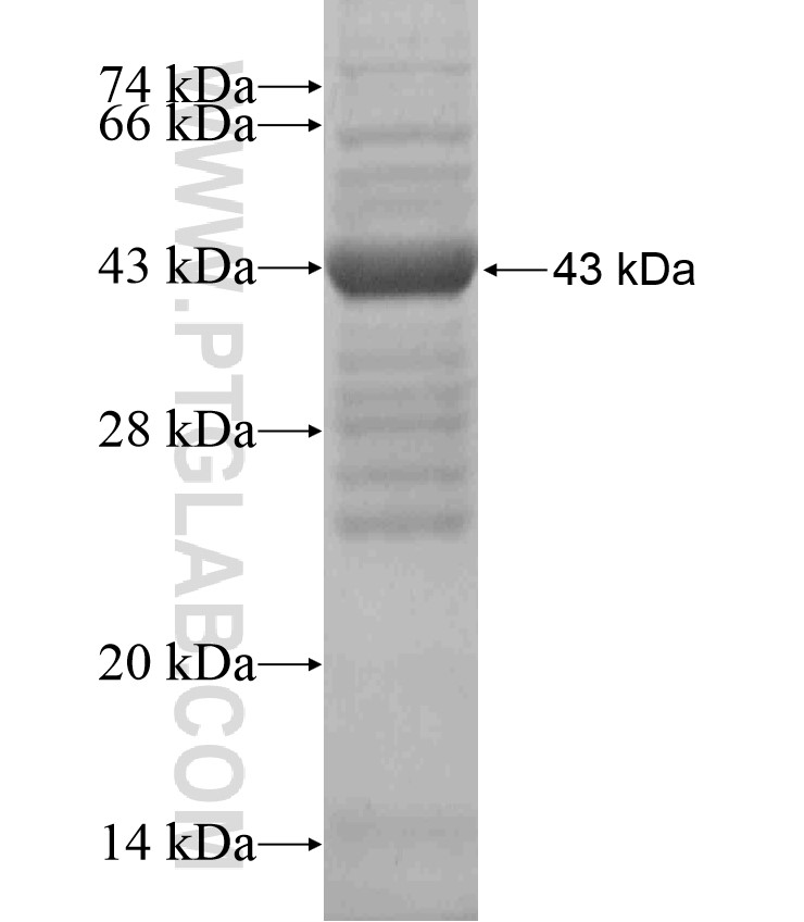 TMEM134 fusion protein Ag18533 SDS-PAGE TMEM134 fusion protein Ag18533 SDS-PAGE