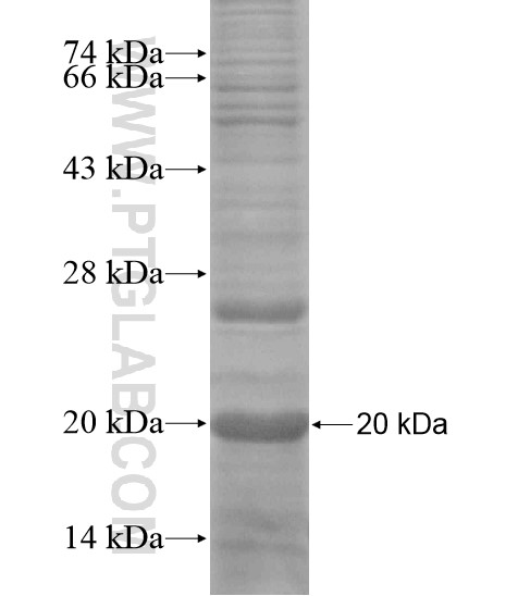 TMEM134 fusion protein Ag18637 SDS-PAGE TMEM134 fusion protein Ag18637 SDS-PAGE