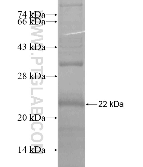 TMEM135 fusion protein Ag20013 SDS-PAGE TMEM135 fusion protein Ag20013 SDS-PAGE