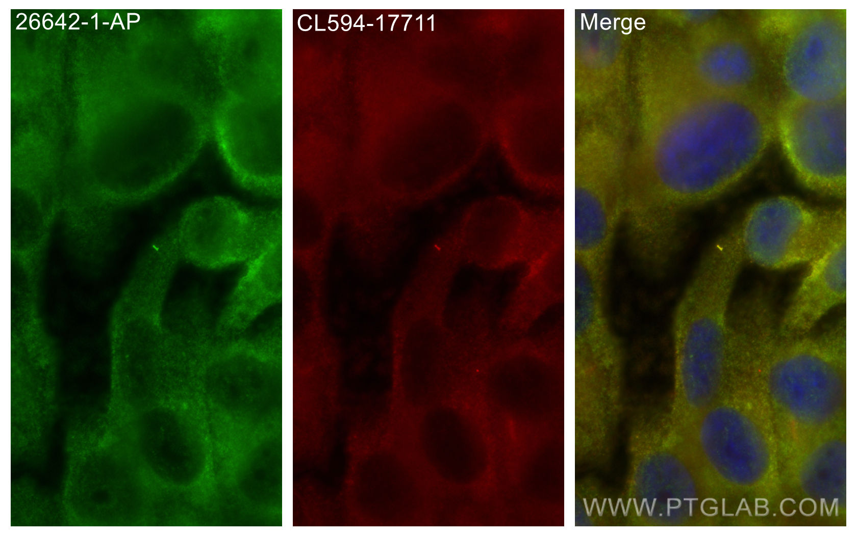 IF Staining of hTERT-RPE1 using 26642-1-AP