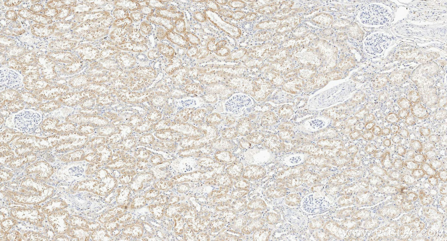 IHC staining of human kidney using 16092-1-AP IHC staining of human kidney using 16092-1-AP