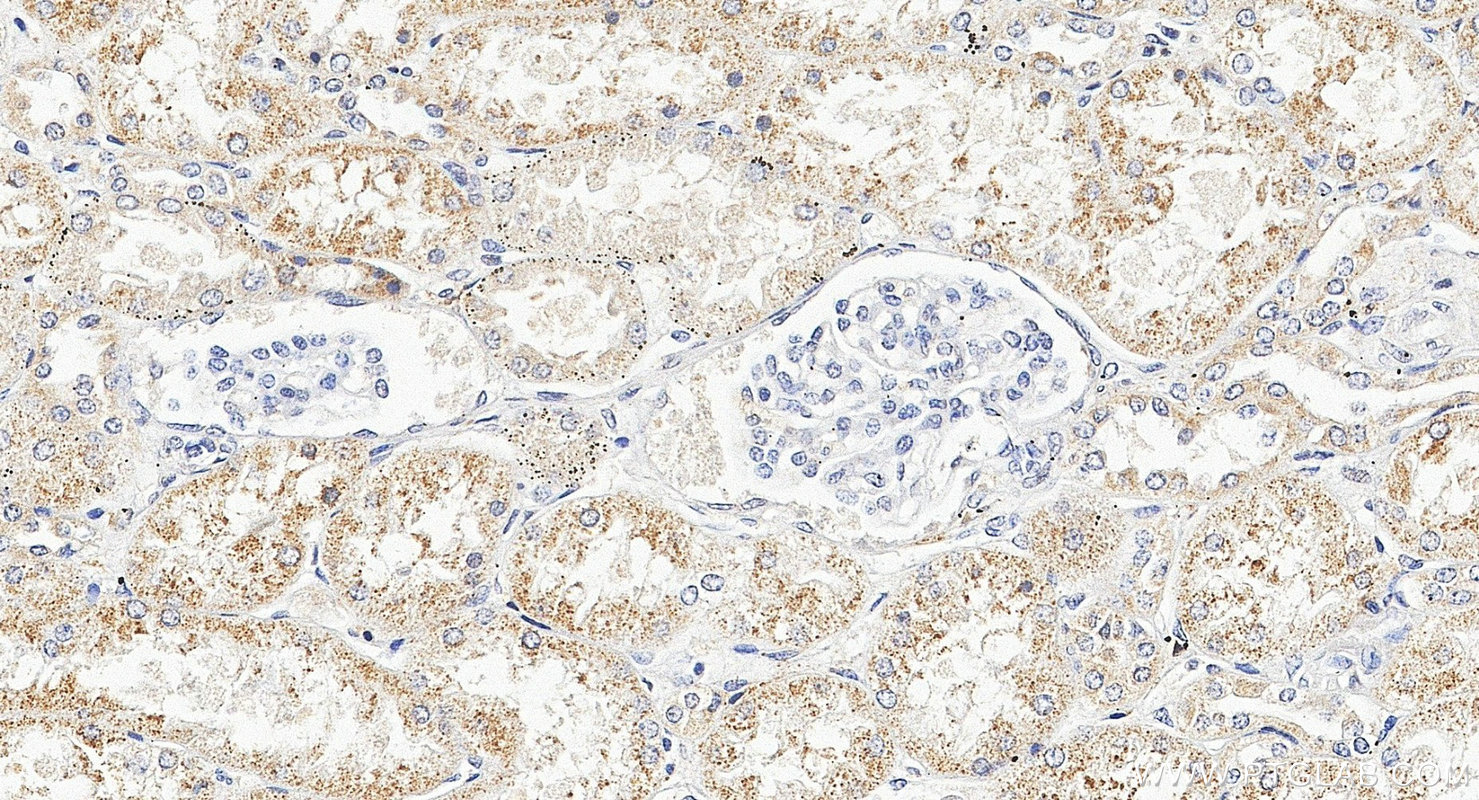 IHC staining of human kidney using 16092-1-AP IHC staining of human kidney using 16092-1-AP