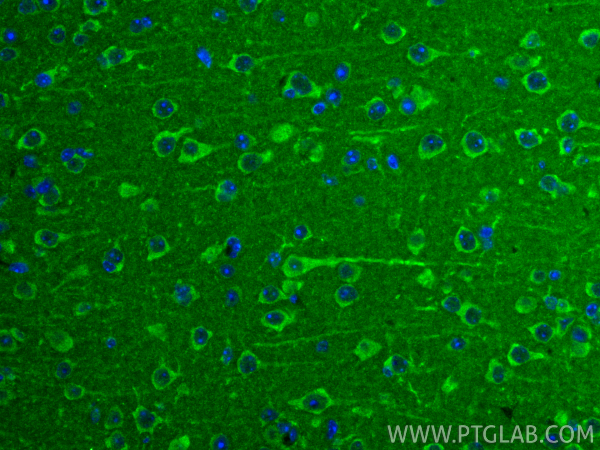 IF Staining of mouse brain using 31917-1-AP (same clone as 31917-1-PBS)