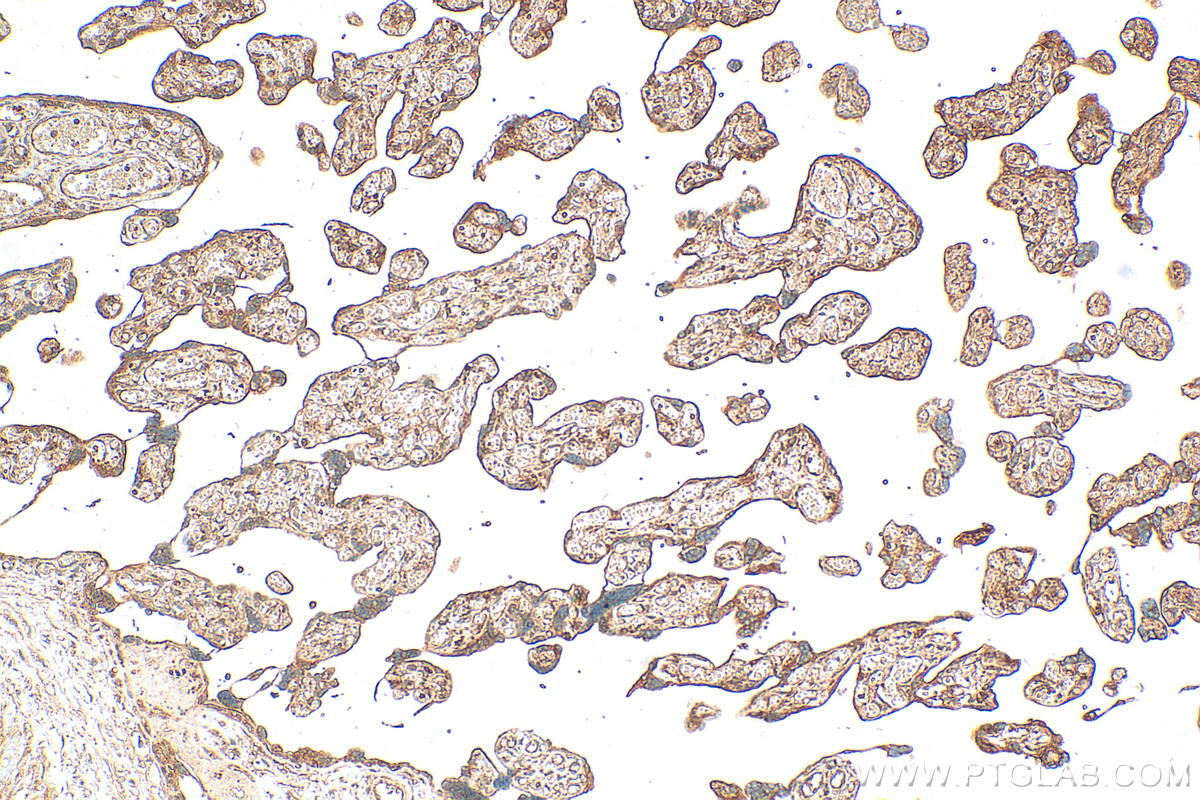 IHC staining of human placenta using 31917-1-AP