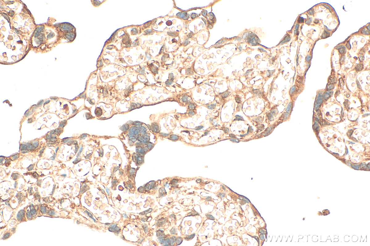 IHC staining of human placenta using 31917-1-AP