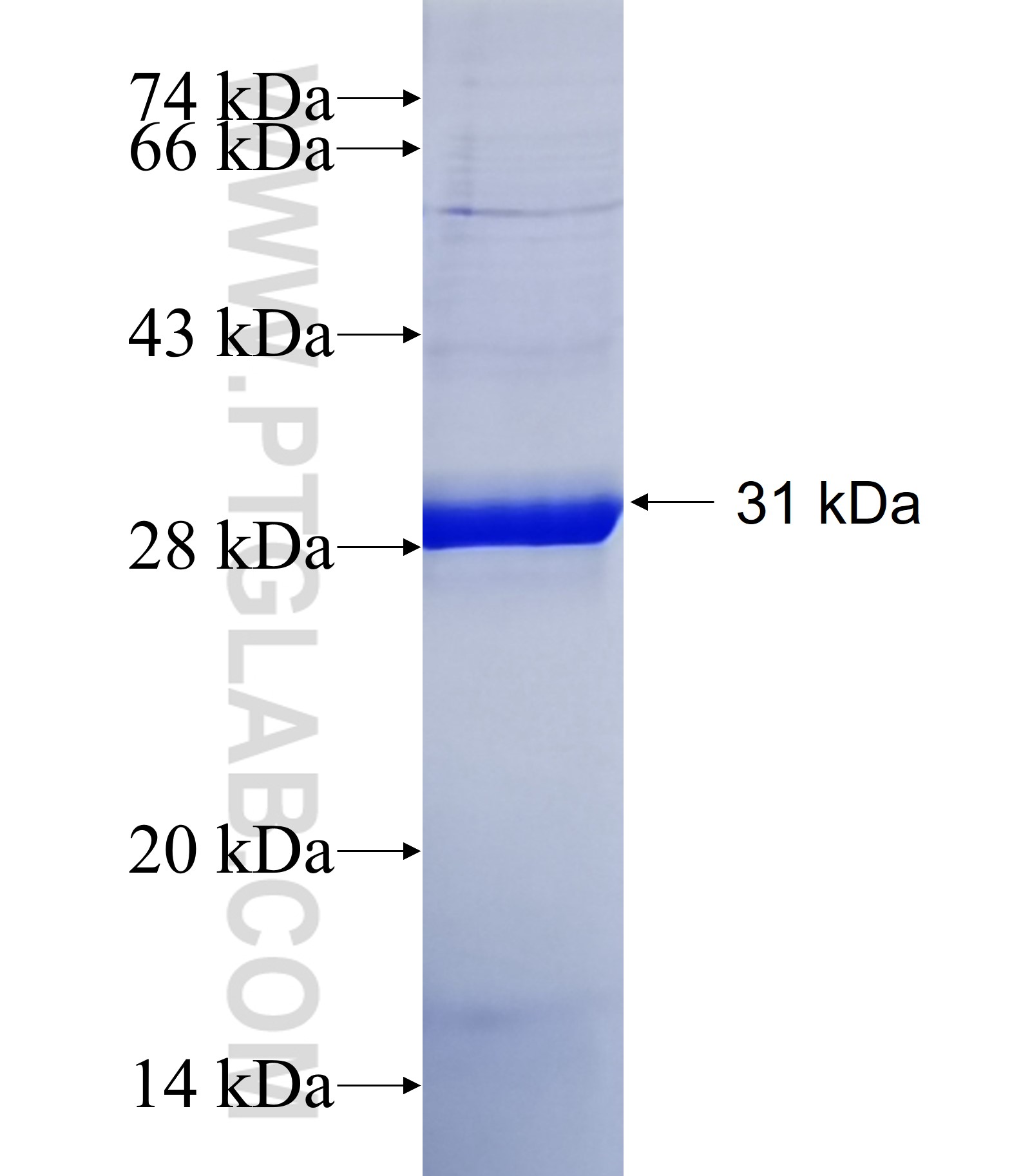 TMEM144 fusion protein Ag40669 SDS-PAGE TMEM144 fusion protein Ag40669 SDS-PAGE