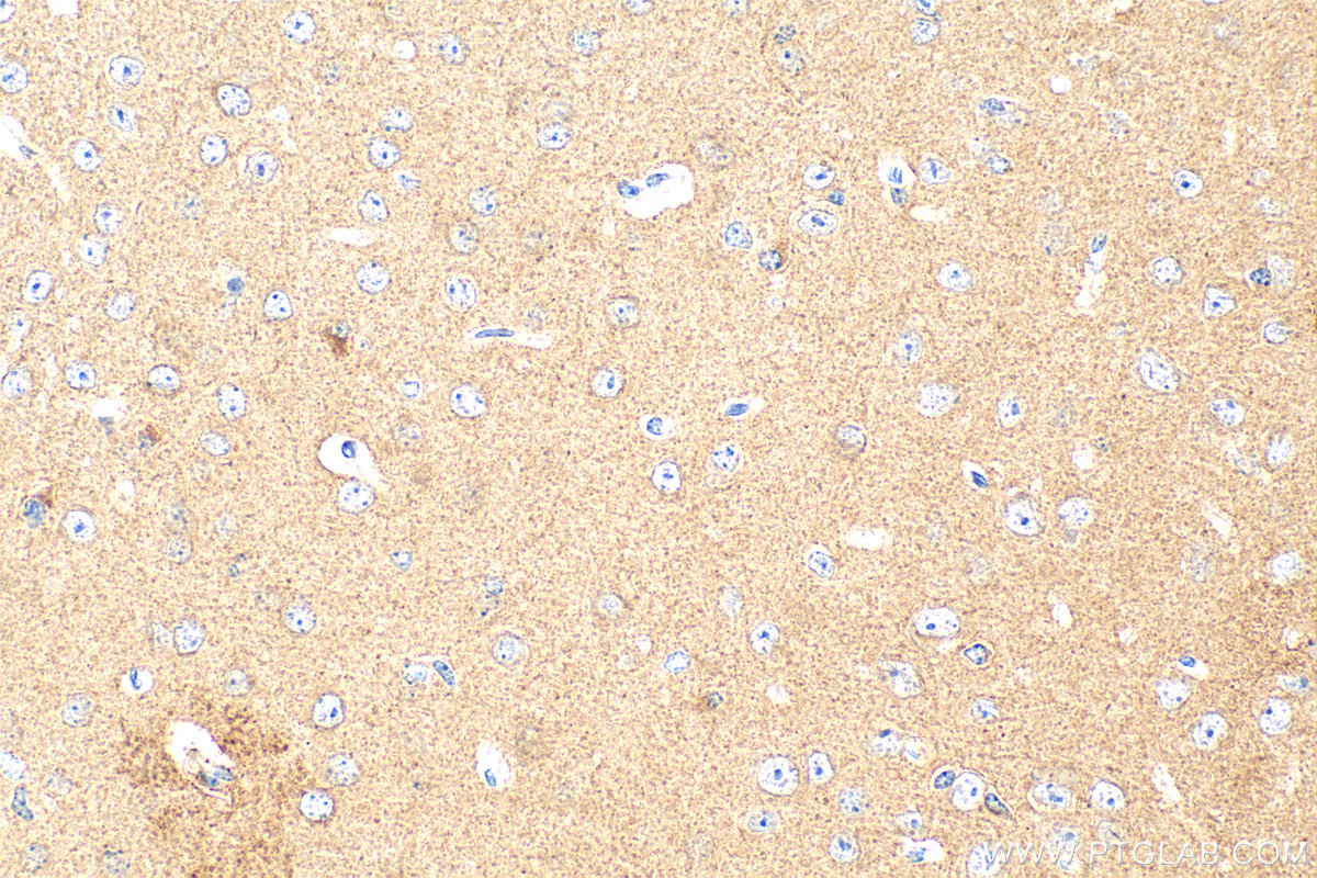 IHC staining of mouse brain using 31640-1-AP