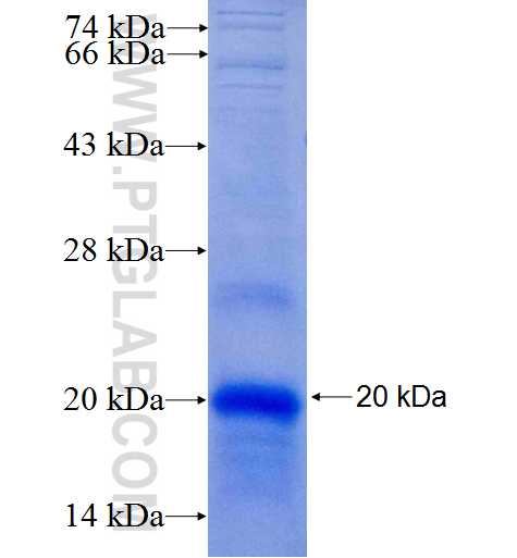 TMEM158 fusion protein Ag24603 SDS-PAGE TMEM158 fusion protein Ag24603 SDS-PAGE