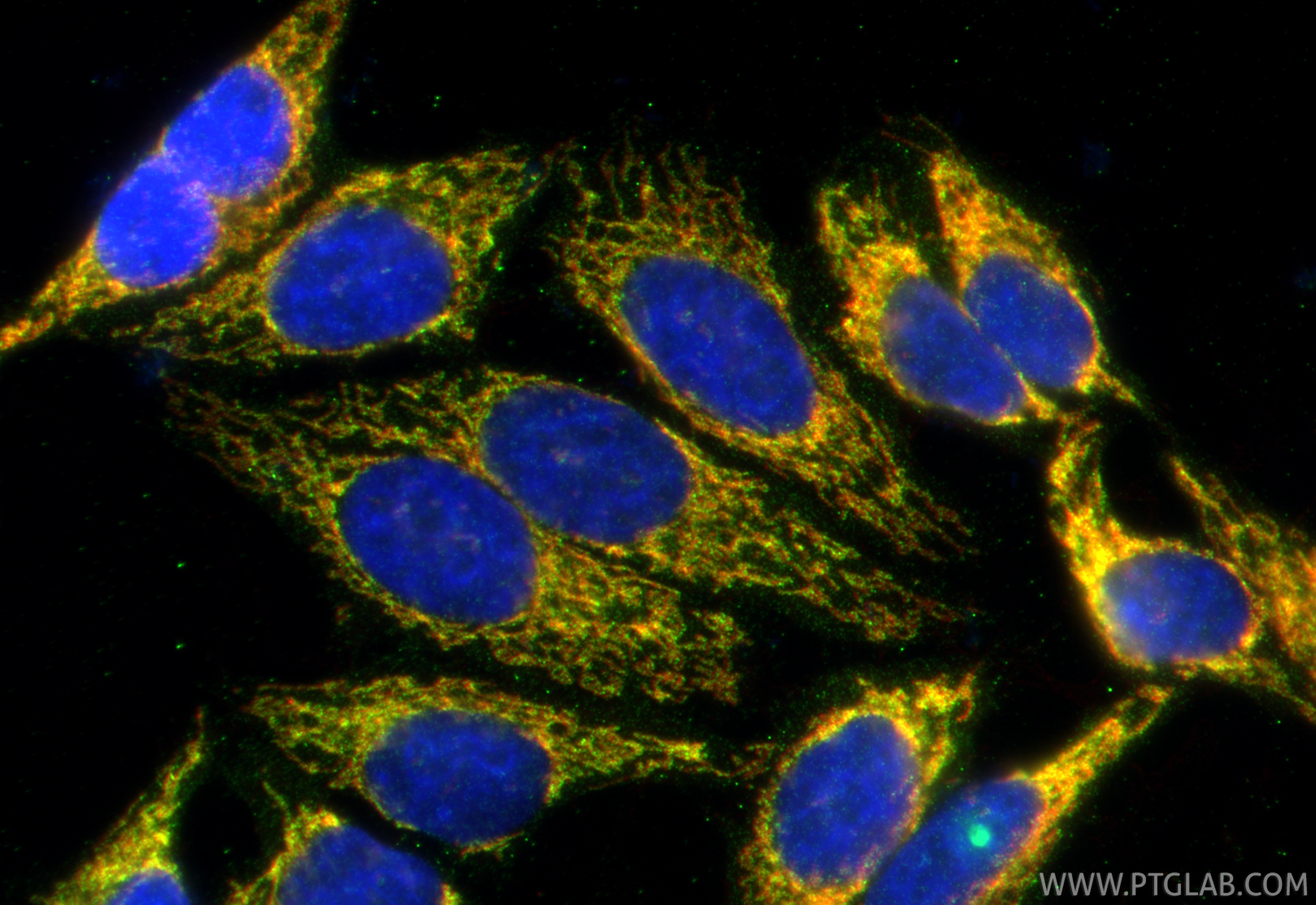 IF Staining of HepG2 using 26451-1-AP (same clone as 26451-1-PBS)