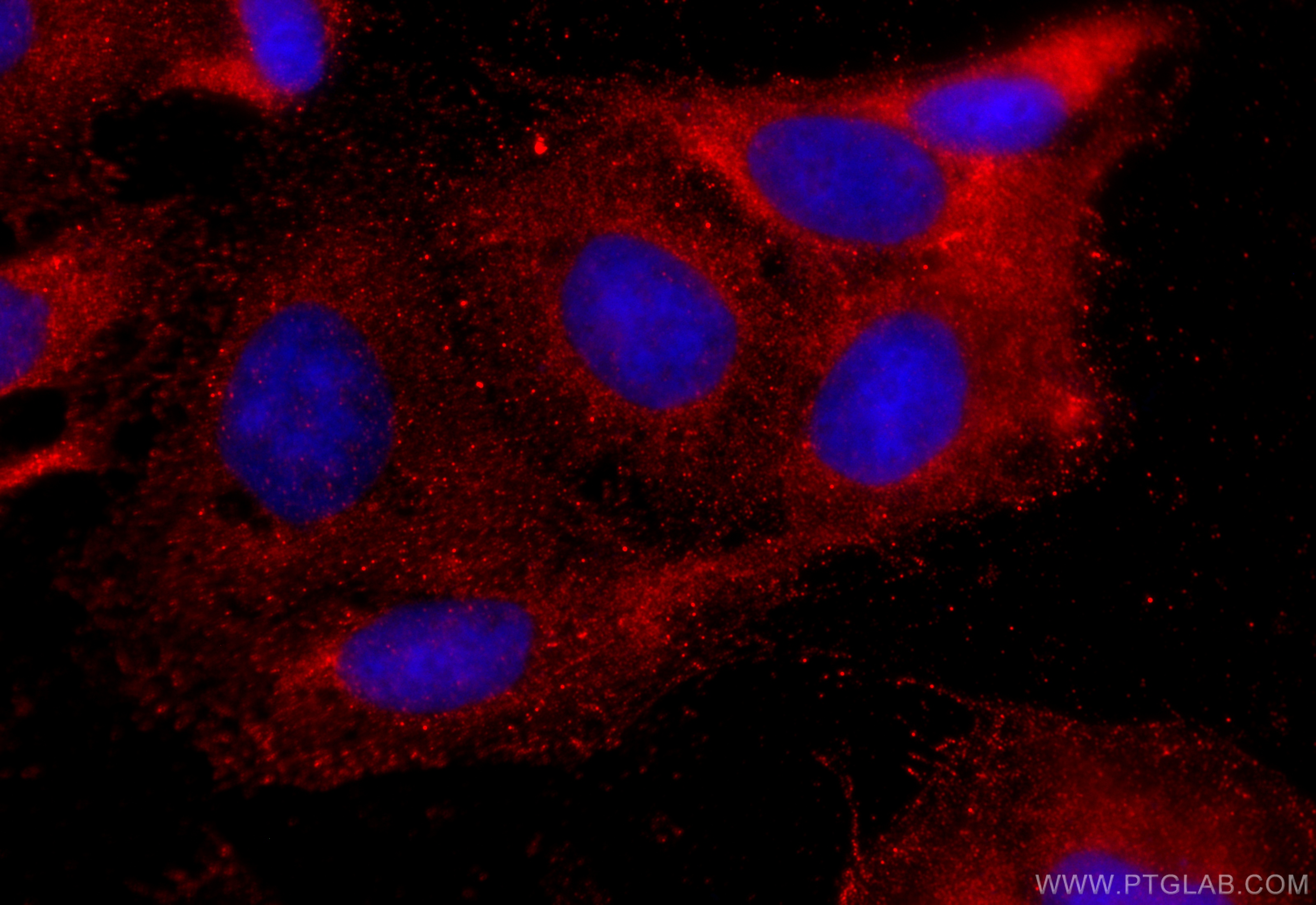 IF Staining of U2OS using 31625-1-AP IF Staining of U2OS using 31625-1-AP