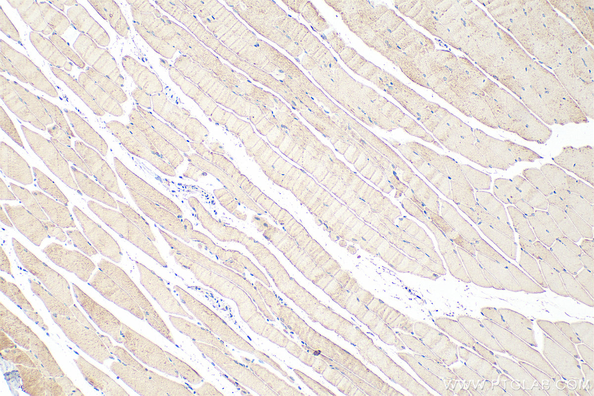 IHC staining of mouse skeletal muscle using 31625-1-AP IHC staining of mouse skeletal muscle using 31625-1-AP