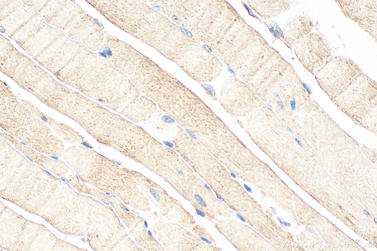IHC staining of mouse skeletal muscle using 31625-1-AP IHC staining of mouse skeletal muscle using 31625-1-AP