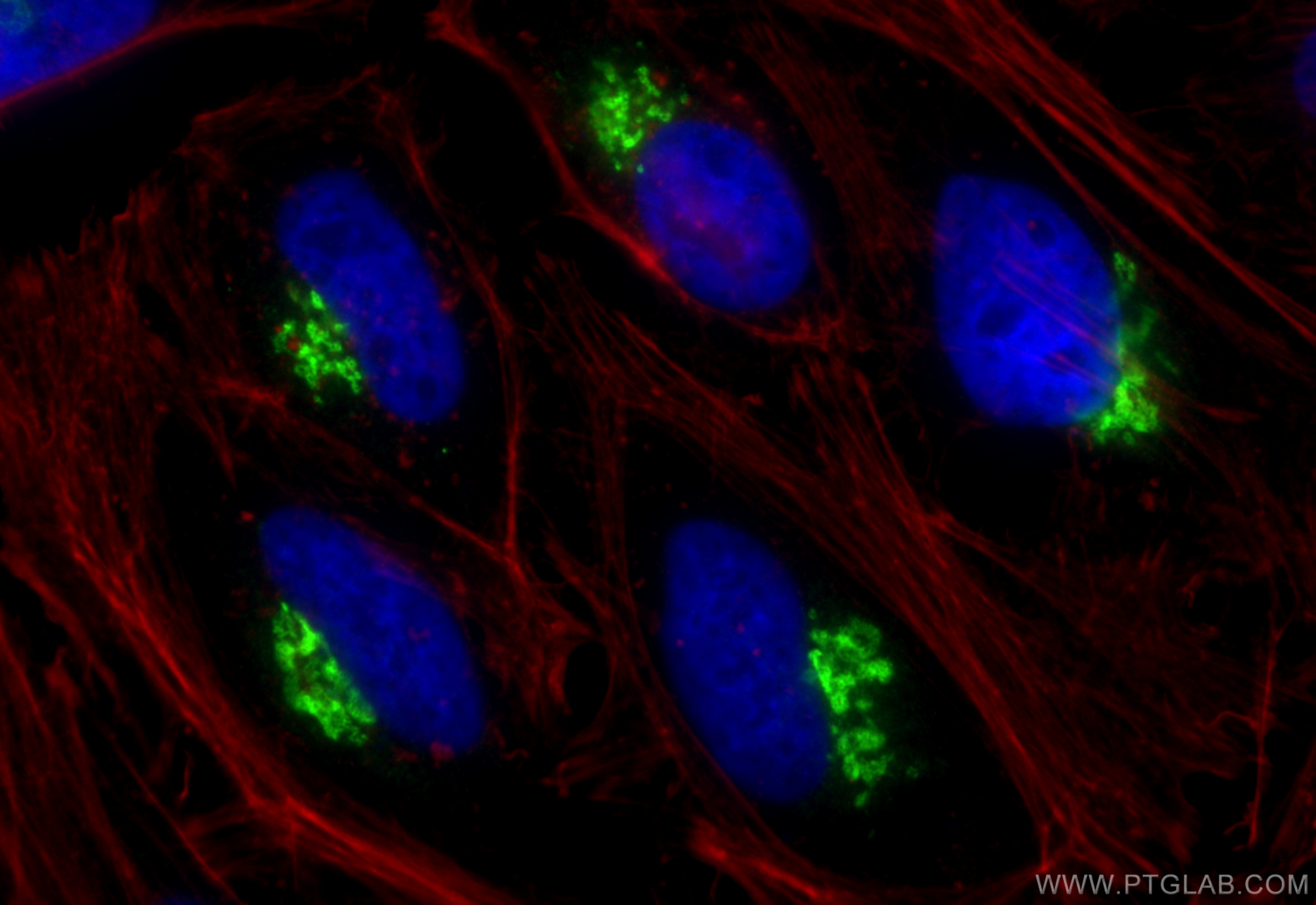 IF Staining of HeLa using 20485-1-AP