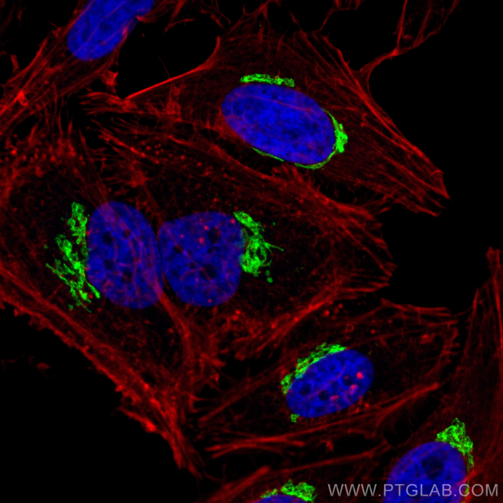 IF Staining of HeLa using 20485-1-AP