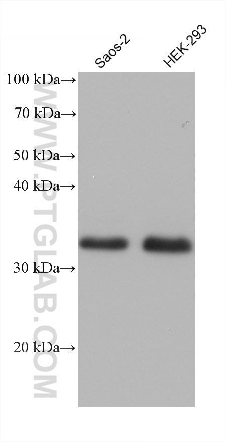 WB analysis using 68584-1-Ig