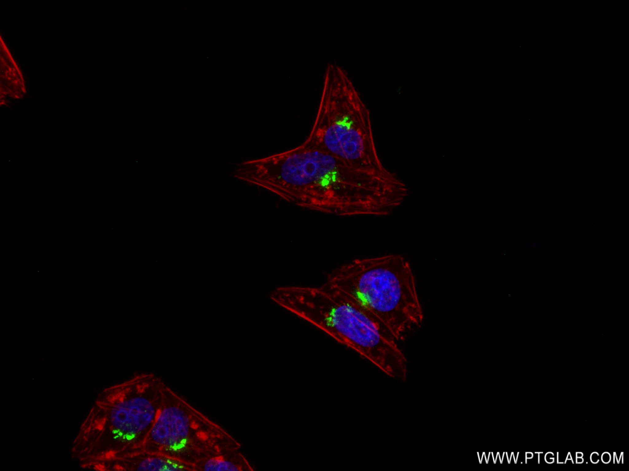 IF Staining of HepG2 using 83146-1-RR (same clone as 83146-1-PBS)