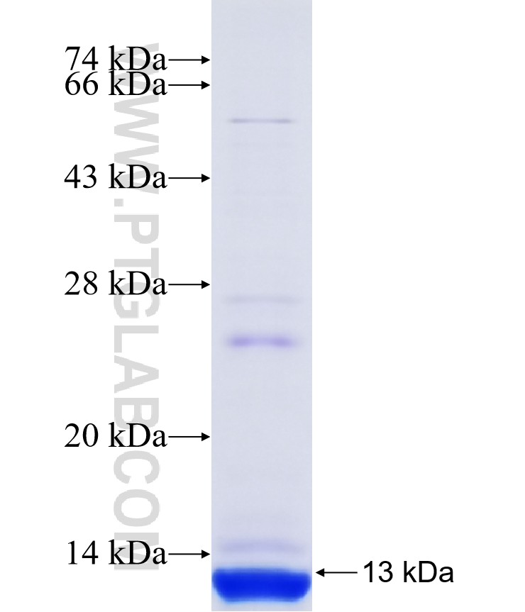 TMEM167B fusion protein Ag18980 SDS-PAGE TMEM167B fusion protein Ag18980 SDS-PAGE