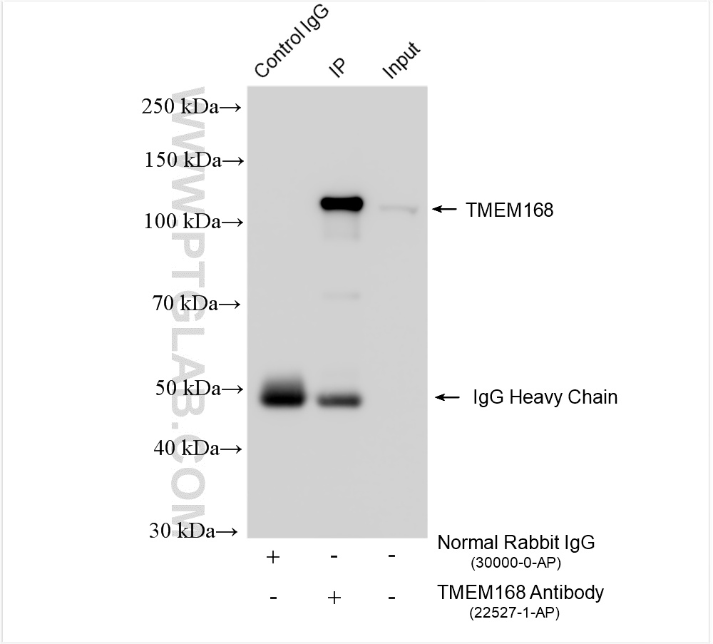 IP experiment of mouse brain using 22527-1-AP