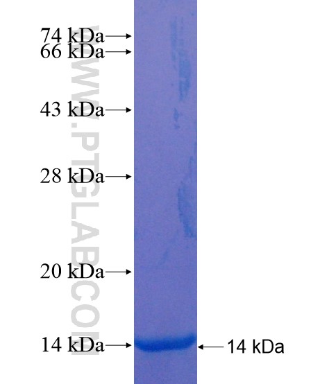 TMEM17 fusion protein Ag19615 SDS-PAGE TMEM17 fusion protein Ag19615 SDS-PAGE
