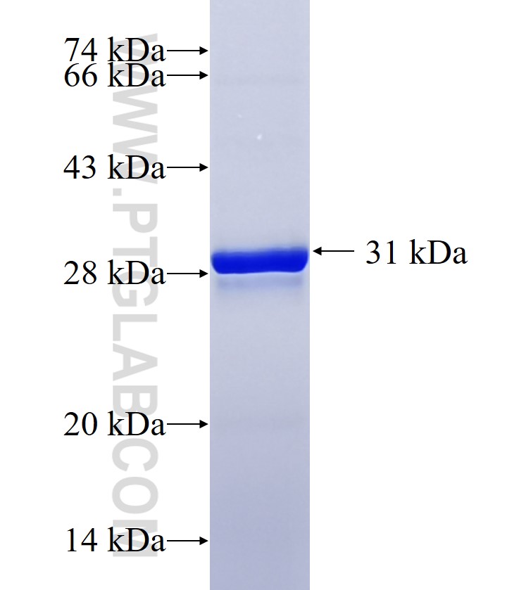 TMEM170A fusion protein Ag21371 SDS-PAGE TMEM170A fusion protein Ag21371 SDS-PAGE