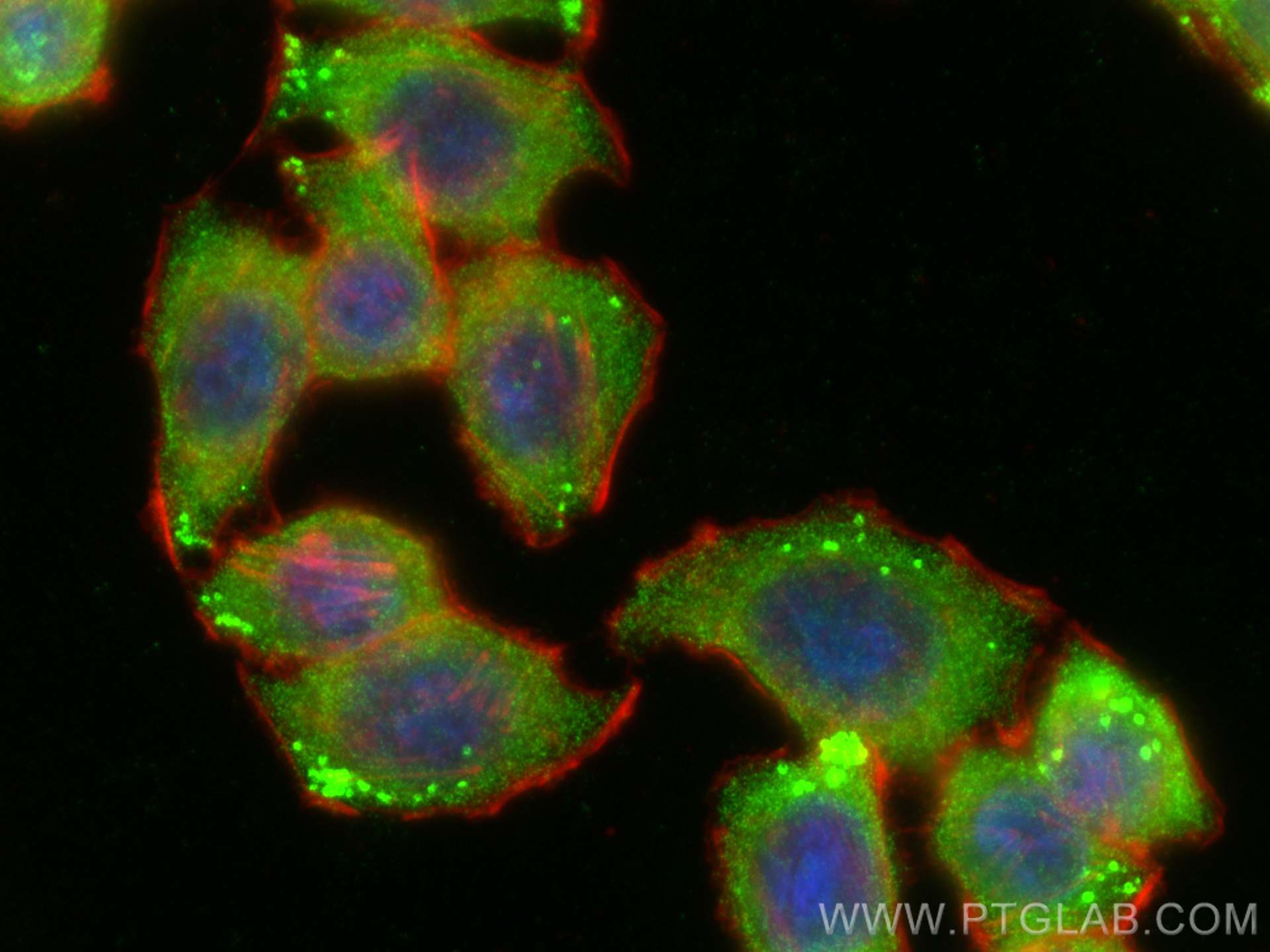 IF Staining of HT-29 using 19851-1-AP