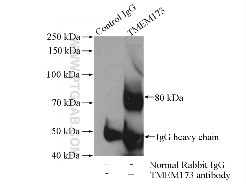 IP experiment of mouse spleen using 19851-1-AP