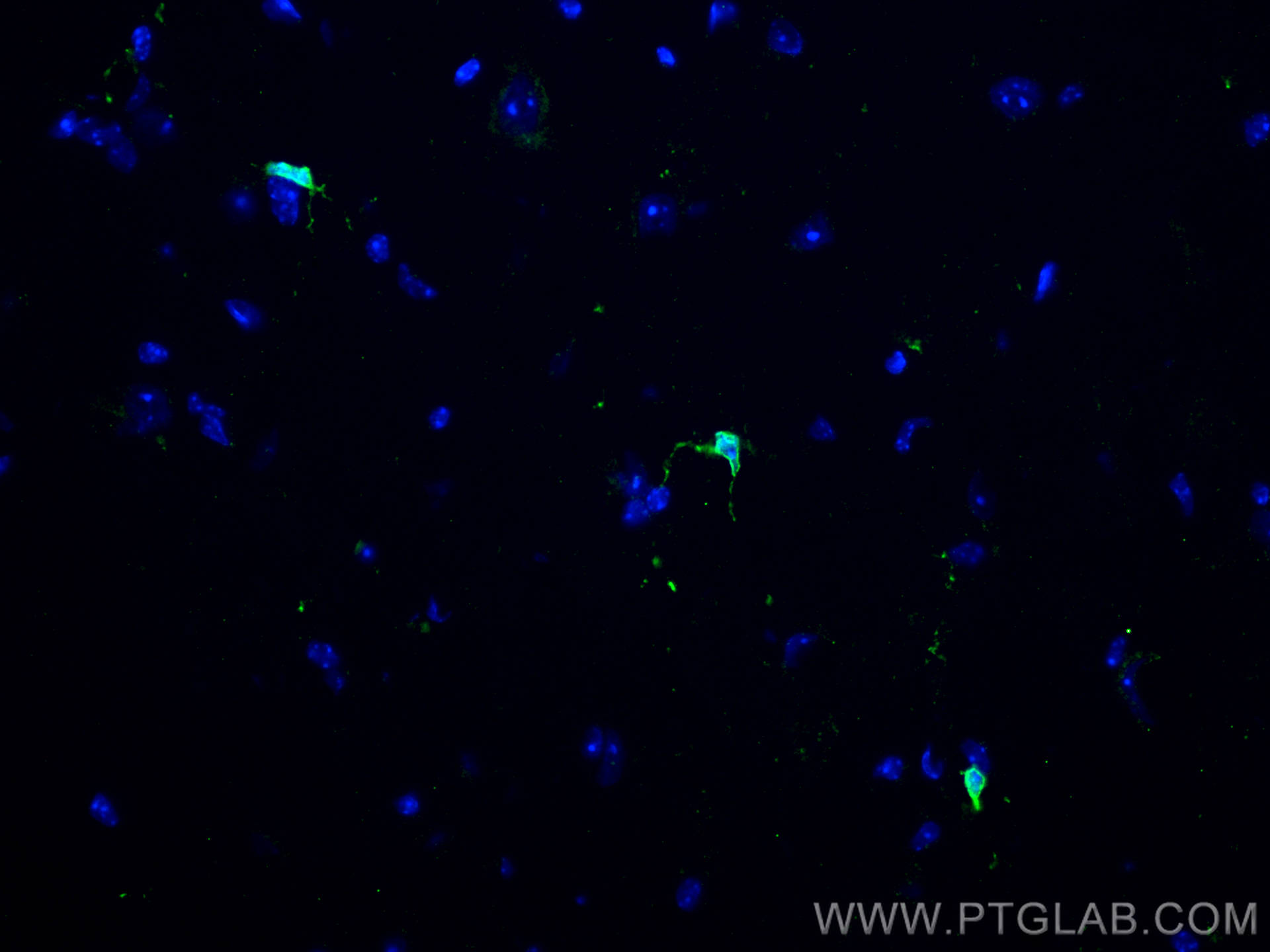 IF Staining of mouse cerebellum using 80165-1-RR (same clone as 80165-1-PBS)