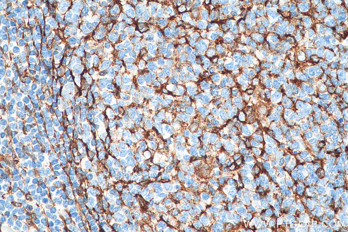 IHC staining of human tonsillitis using 80165-1-RR