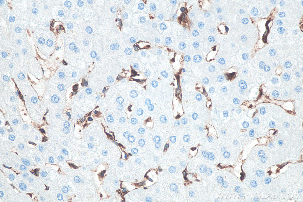 IHC staining of human liver using 80165-1-RR IHC staining of human liver using 80165-1-RR
