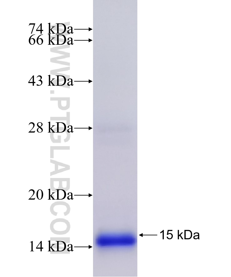 TMEM175 fusion protein Ag17102 SDS-PAGE TMEM175 fusion protein Ag17102 SDS-PAGE