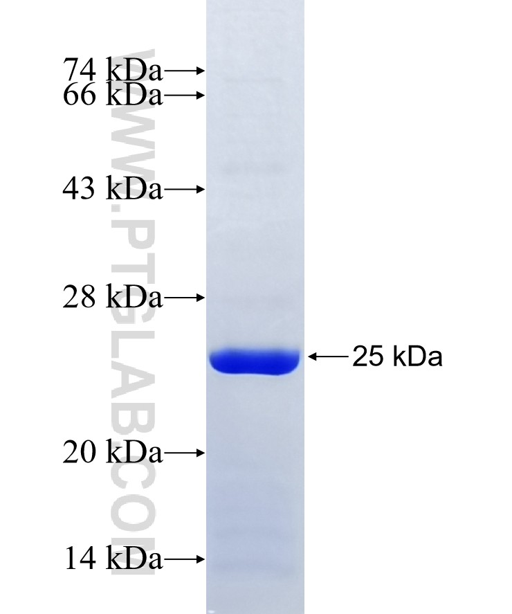 TMEM177 fusion protein Ag14782 SDS-PAGE