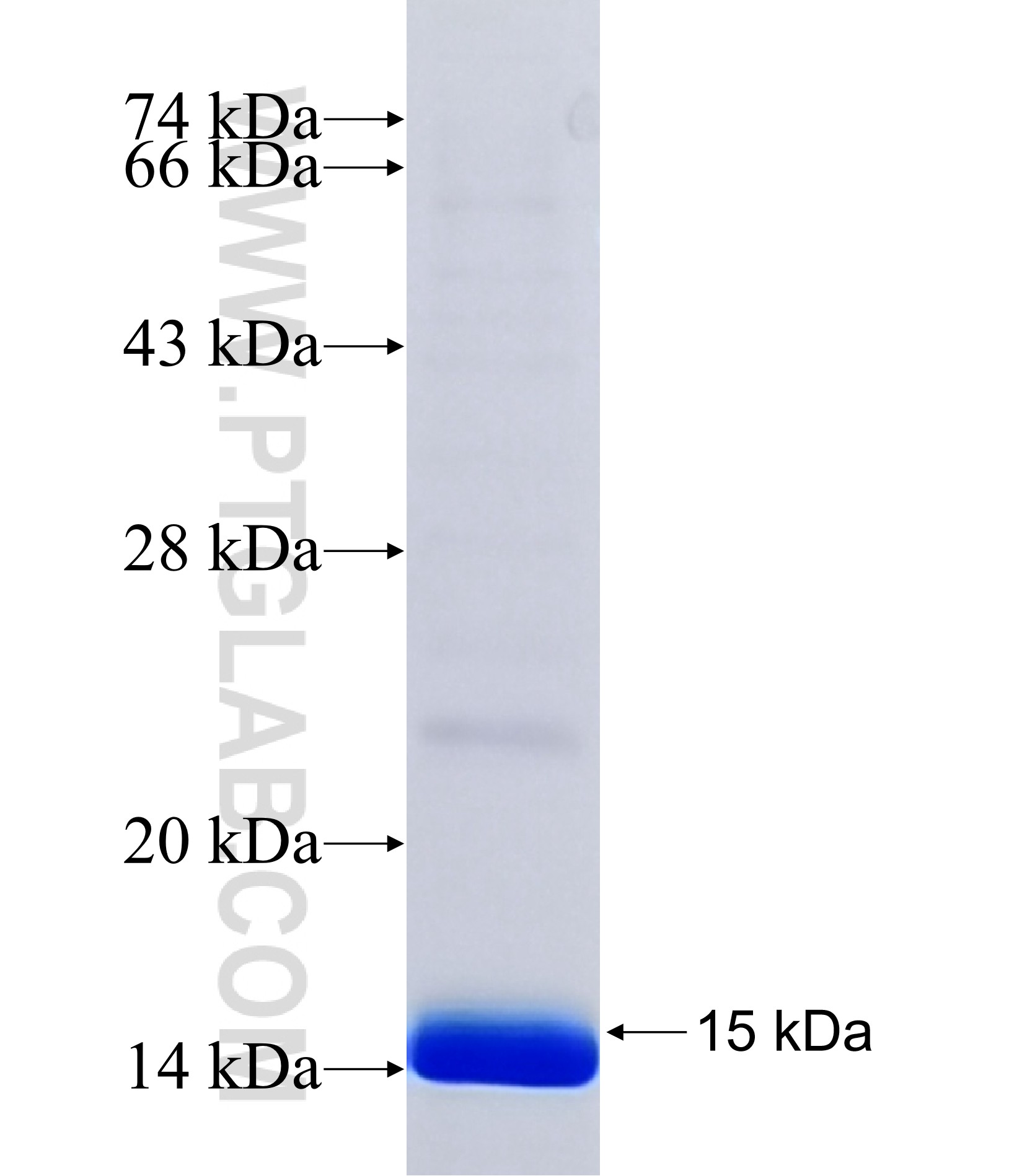 TMEM178 fusion protein Ag41895 SDS-PAGE TMEM178 fusion protein Ag41895 SDS-PAGE