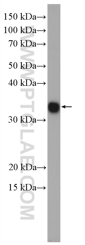 WB analysis of mouse liver using 24799-1-AP (same clone as 24799-1-PBS)