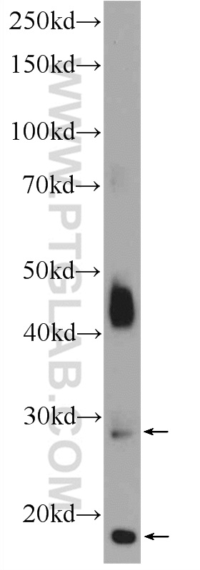 WB analysis of mouse skeletal muscle using 25366-1-AP