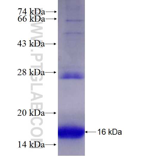 TMEM184B fusion protein Ag27960 SDS-PAGE TMEM184B fusion protein Ag27960 SDS-PAGE
