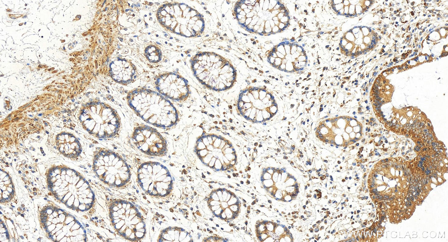 IHC staining of human colon using 31293-1-AP