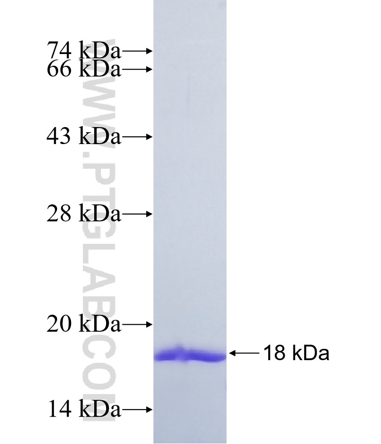 TMEM19 fusion protein Ag37193 SDS-PAGE