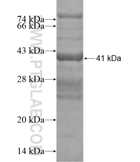 TMEM190 fusion protein Ag19076 SDS-PAGE TMEM190 fusion protein Ag19076 SDS-PAGE