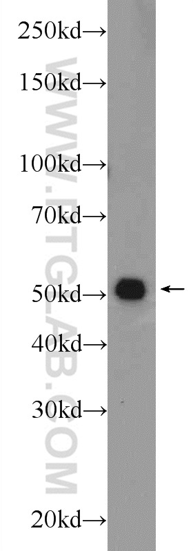 WB analysis of MCF-7 using 24477-1-AP