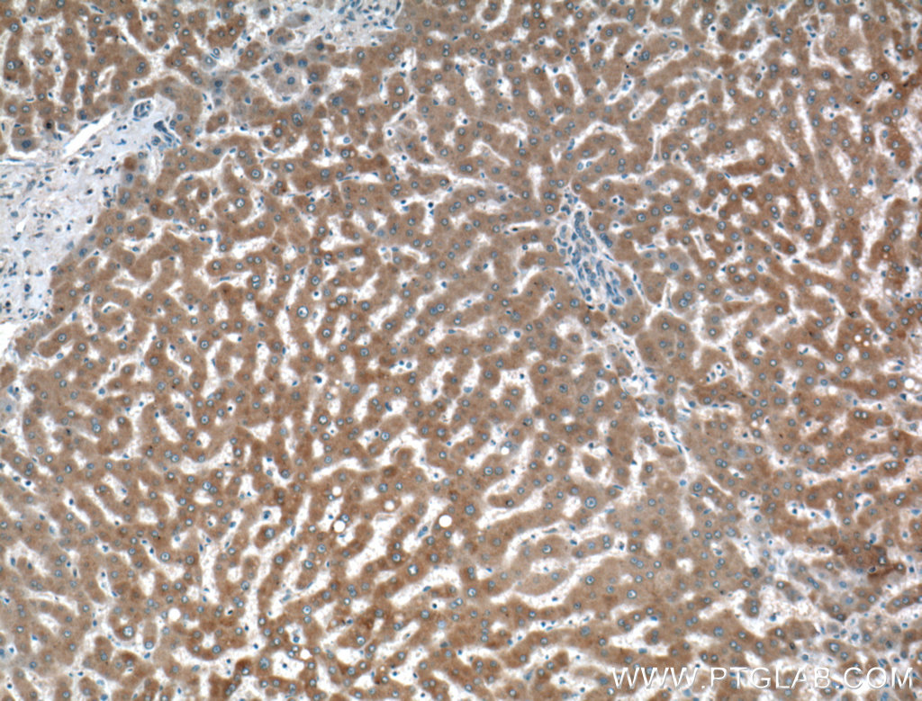 Immunohistochemical analysis of paraffin-embedded human liver tissue slide using 21355-1-AP (TMEM195 antibody) at dilution of 1:200 (under 10x lens). IHC staining of human liver using 21355-1-AP