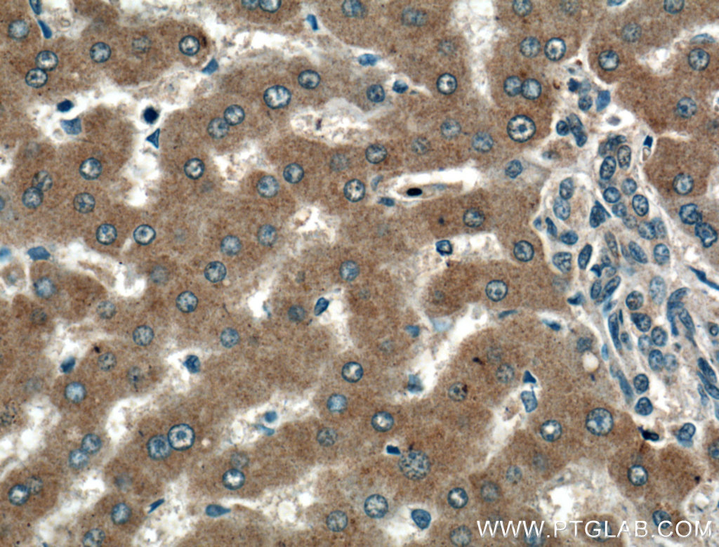 Immunohistochemical analysis of paraffin-embedded human liver tissue slide using 21355-1-AP (TMEM195 antibody) at dilution of 1:200 (under 40x lens). IHC staining of human liver using 21355-1-AP