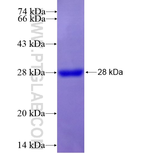 TMEM195 fusion protein Ag15774 SDS-PAGE TMEM195 fusion protein Ag15774 SDS-PAGE