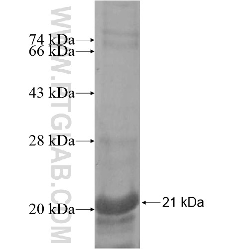 TMEM200B fusion protein Ag12070 SDS-PAGE TMEM200B fusion protein Ag12070 SDS-PAGE