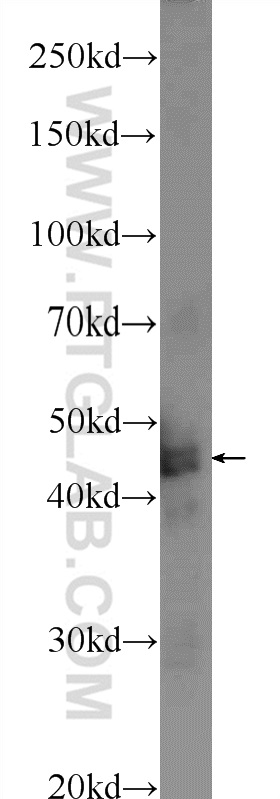 WB analysis of mouse brain using 24092-1-AP