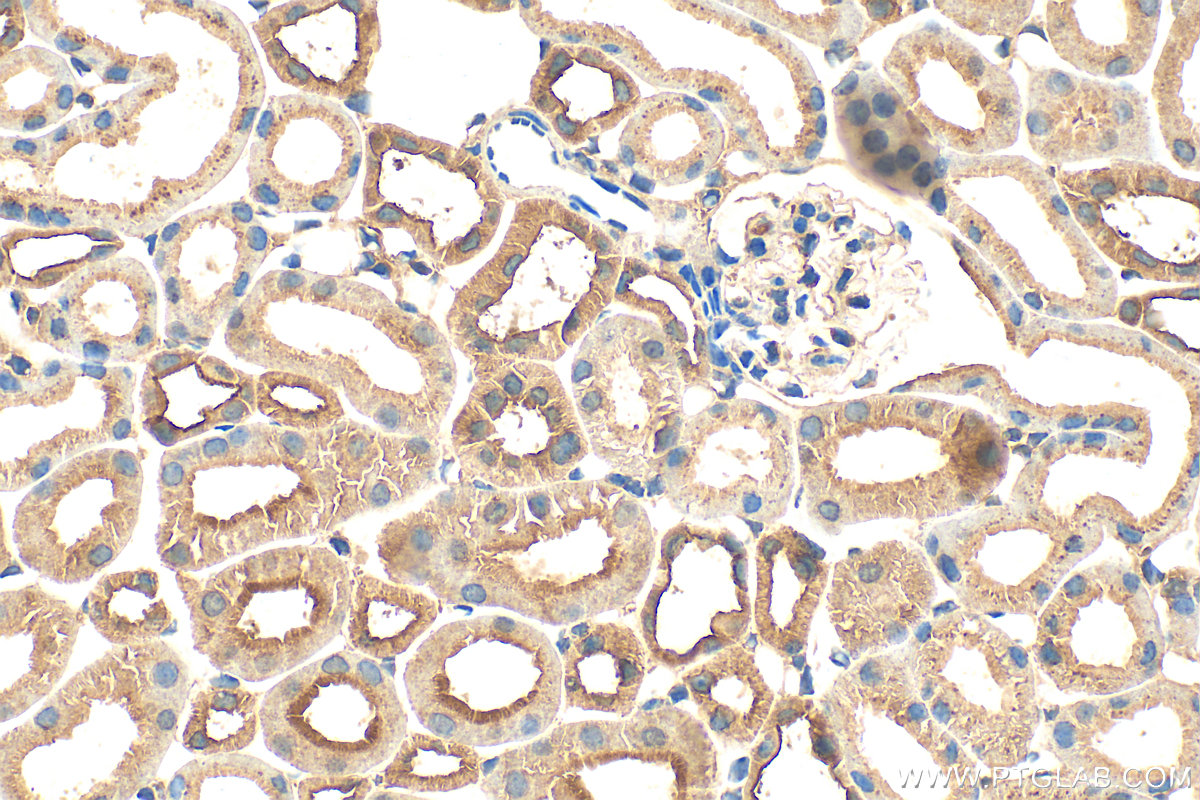 IHC staining of mouse kidney using 20479-1-AP